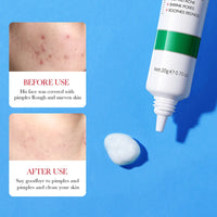 BIOAQUA Salicylic Acid Acne Removing Cream Face Moisturizing Repairing Anti Acne Removal Anti-aging Facial Creams Skin Care
