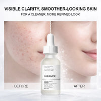 Salicylic Acid 2% Facial Essence, Acne-Fighting Serum for Blemish-Prone,Deep Moisturizing Skin,The Skin Facial Skin Essence New